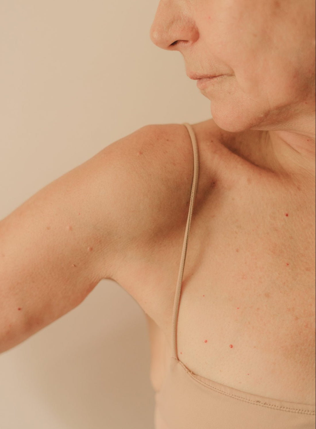 4 Menopause Problems & How to Solve Them